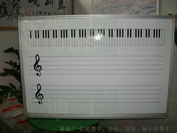 諾迪士訂做UV絲印磁性白板劃線白板表格白板醫(yī)院住院情況白板護士站白板